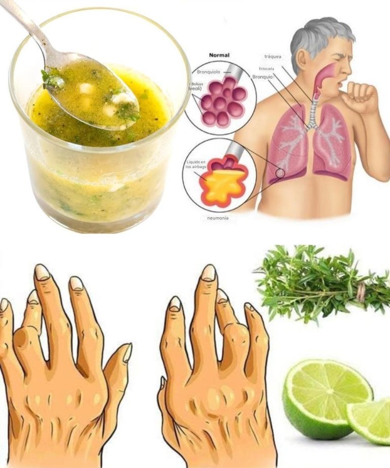 558240864 1327944602210081 146371370531278557 N 768x922